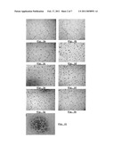 ANTI-TUMOR DRUG, MEDICAMENT, COMPOSITION, AND USE THEREOF diagram and image