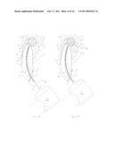 METHOD OF TREATING DENTAL PERIAPICAL LESIONS diagram and image