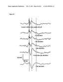 SYSTEM AND METHOD FOR MONITORING CARDIOMYOCYTE BEATING, VIABILITY AND MORPHOLOGY AND FOR SCREENING FOR PHARMACOLOGICAL AGENTS WHICH MAY INDUCE CARDIOTOXICITY OR MODULATE CARDIOMYOCYTE FUNCTION diagram and image