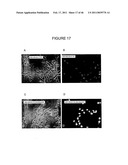 INHIBITORS OF PROTEIN KINASE C ISOFORMS AND USES THEREOF diagram and image