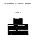 INHIBITORS OF PROTEIN KINASE C ISOFORMS AND USES THEREOF diagram and image