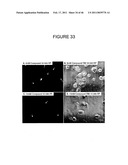 INHIBITORS OF PROTEIN KINASE C ISOFORMS AND USES THEREOF diagram and image