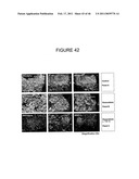 INHIBITORS OF PROTEIN KINASE C ISOFORMS AND USES THEREOF diagram and image