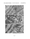 Application of ginsenoside Rb1 in preparing medicaments for treating dilated cardiomyopathy diagram and image