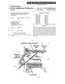 Method and apparatus for weight control by olfactory nerve ablation diagram and image