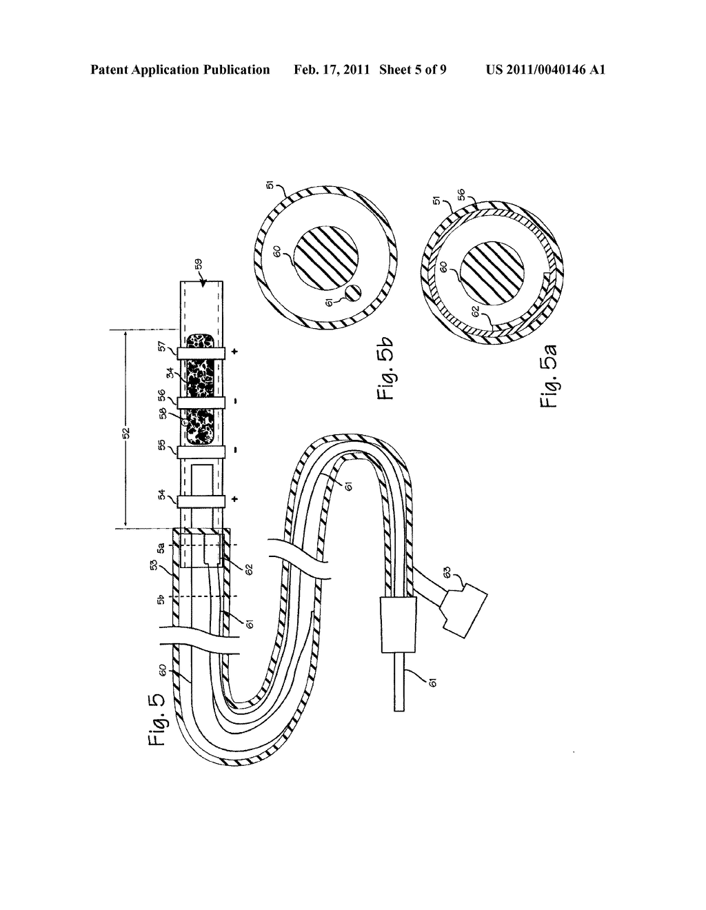 Method and Apparatus for Tubal Occlusion - diagram, schematic, and image 06