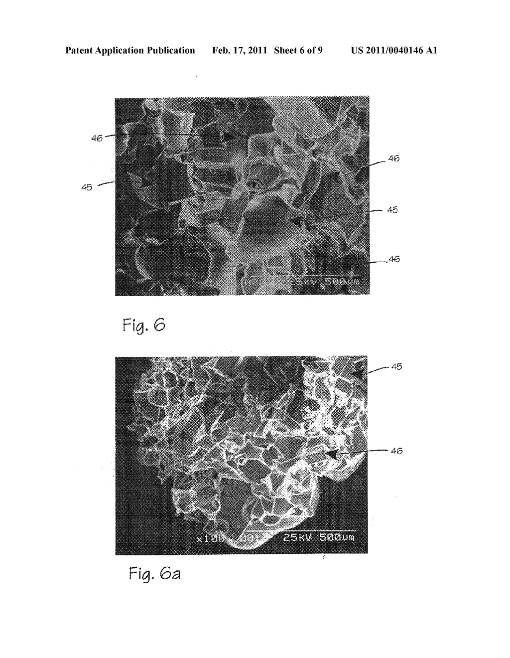 Method and Apparatus for Tubal Occlusion - diagram, schematic, and image 07