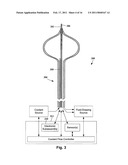 SYSTEMS AND METHODS FOR MAKING AND USING MEDICAL ABLATION SYSTEMS AND HAVING MAPPING CATHETERS WITH IMPROVED ANCHORING ABILITY diagram and image