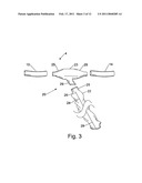 BODY-SPACE DRAINAGE-TUBE DEBRIS REMOVAL diagram and image