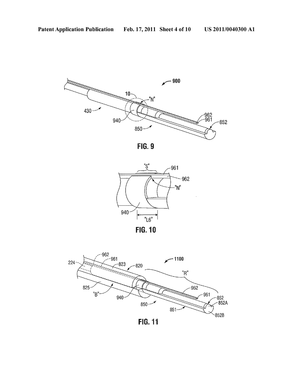 Surface Ablation Antenna with Dielectric Loading - diagram, schematic, and image 05