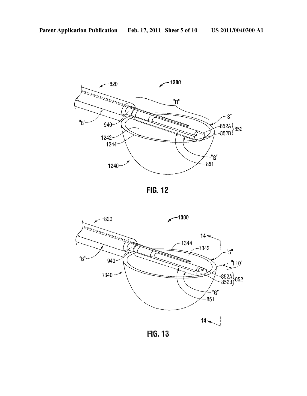 Surface Ablation Antenna with Dielectric Loading - diagram, schematic, and image 06