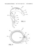 IMPLANTABLE RESTRICTION DEVICE WITH SPACER diagram and image
