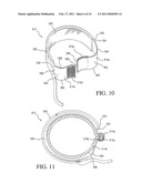 IMPLANTABLE RESTRICTION DEVICE WITH SPACER diagram and image
