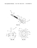 SPINOUS PROCESS SPACER AND IMPLANTATION PROCEDURE diagram and image