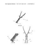 SPINOUS PROCESS SPACER AND IMPLANTATION PROCEDURE diagram and image