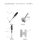 SPINOUS PROCESS SPACER AND IMPLANTATION PROCEDURE diagram and image