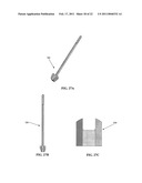 SPINOUS PROCESS SPACER AND IMPLANTATION PROCEDURE diagram and image