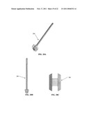 SPINOUS PROCESS SPACER AND IMPLANTATION PROCEDURE diagram and image