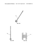 SPINOUS PROCESS SPACER AND IMPLANTATION PROCEDURE diagram and image