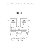 Instruments and Methods for Minimally Invasive Spine Surgery diagram and image