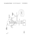 DORSAL COLUMN STIMULATION THERAPY diagram and image