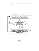 DORSAL COLUMN STIMULATION THERAPY diagram and image