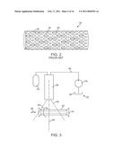 METHOD AND SYSTEM FOR ALIGNING A STENT WITH A STENT SUPPORT diagram and image