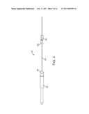 METHOD AND SYSTEM FOR ALIGNING A STENT WITH A STENT SUPPORT diagram and image