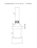 METHOD AND SYSTEM FOR ALIGNING A STENT WITH A STENT SUPPORT diagram and image