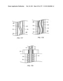 IRREGULAR PATTERN TREATMENT OF A SUBSURFACE FORMATION diagram and image