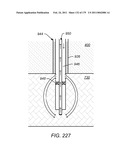 IRREGULAR PATTERN TREATMENT OF A SUBSURFACE FORMATION diagram and image