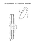 IRREGULAR PATTERN TREATMENT OF A SUBSURFACE FORMATION diagram and image