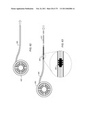 IRREGULAR PATTERN TREATMENT OF A SUBSURFACE FORMATION diagram and image