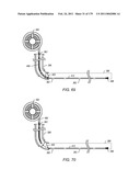 IRREGULAR PATTERN TREATMENT OF A SUBSURFACE FORMATION diagram and image