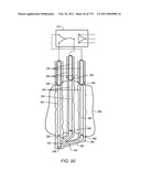 IRREGULAR PATTERN TREATMENT OF A SUBSURFACE FORMATION diagram and image