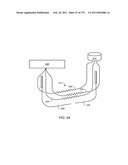 IRREGULAR PATTERN TREATMENT OF A SUBSURFACE FORMATION diagram and image