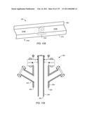 IRREGULAR PATTERN TREATMENT OF A SUBSURFACE FORMATION diagram and image