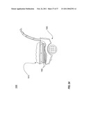 COLLAPSIBLE COOLERS diagram and image