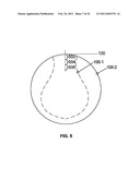 Multiple Layer Multifocal Composite Lens diagram and image