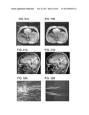 TOOL FOR ACCURATE QUANTIFICATION IN MOLECULAR MRI diagram and image