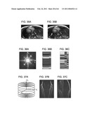 TOOL FOR ACCURATE QUANTIFICATION IN MOLECULAR MRI diagram and image