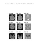 TOOL FOR ACCURATE QUANTIFICATION IN MOLECULAR MRI diagram and image