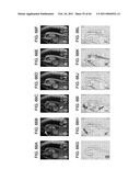 TOOL FOR ACCURATE QUANTIFICATION IN MOLECULAR MRI diagram and image