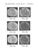 Use of Functionalized Magnetic Nanoparticles in Cancer Detection and Treatment diagram and image