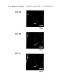 MEDICAMENT, DENTAL MATERIAL, AND METHOD OF SCREENING diagram and image