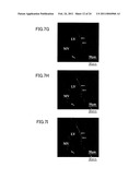 MEDICAMENT, DENTAL MATERIAL, AND METHOD OF SCREENING diagram and image