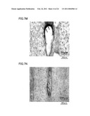 MEDICAMENT, DENTAL MATERIAL, AND METHOD OF SCREENING diagram and image