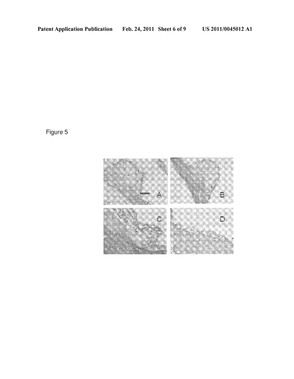 ANTI-ATHEROMA VACCINE - diagram, schematic, and image 07