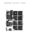 Production of and uses for decellularized lung tissue diagram and image