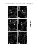 ISOLATED POPULATION OF LUMINAL STEM CELLS THAT GIVE RISE TO PROSTATE CANCER AND METHODS OF USING SAME diagram and image